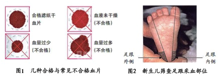 新生兒采血卡廠家解讀：新生兒篩查